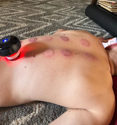 Intelligent Vacuum Cupping Massage